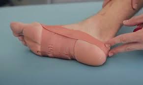 Image result for Taping for Soleus and Achilles