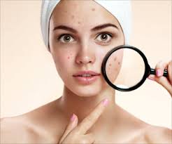 The greatest kinds of beauty appear natural at the very least. Natural Ways To Remove Blackheads On Face And Nose Beauty Tips