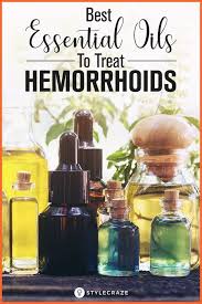 Essential Oils The Best Way To Treat Hemorrhoids Health Wellness Cure For Hemorrhoids Essential Oil For Hemorrhoids Hemorrhoid Remedies