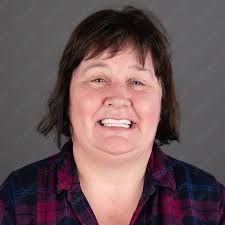 Western Health Turkey