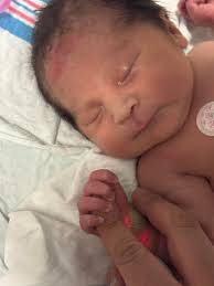 Experiences with Hospital Care in PA