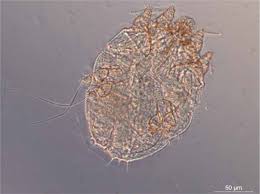 Image result for Sarcoptes scabiei life cycle