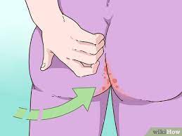 Check spelling or type a new query. Cara Membasmi Cacing Kerawit 12 Langkah Dengan Gambar Wikihow