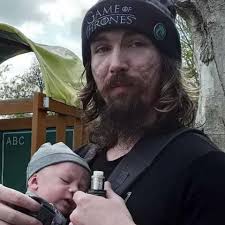 Fundraiser by Dillon Mooney : Help send new father to dermatologist for  Scarring