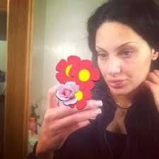 Eva Rivas had an accident