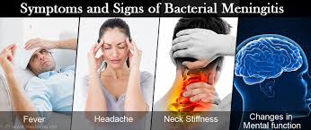 Treatment of mild cases of viral meningitis usually includes: Bacterial Meningitis Causes Symptoms Diagnosis Treatment Prevention