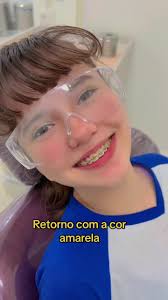 Retorno com após 30dias com a borrachinha amarelo,sem desbotar#fypシ #a...