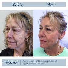 Rachel Danielle (@rd_aestheticnurse) • Instagram photos and videos