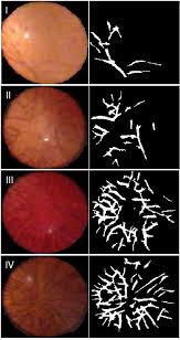 frontiers estimation of gestational age via image analysis