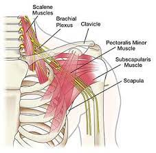 Po box 2546, orofino, id 83544. Shoulder Arm Pain Treatment Doctors Top Pain Specialists Brooklyn