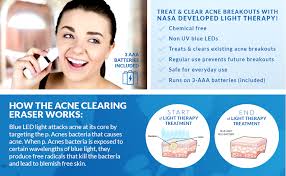 Amazon Com Acne Clearing Eraser A C E Blue Led Light Therapy Beauty