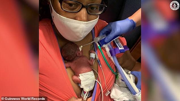 Weighing only 420 g (14.8 oz) as a newborn, he was about the size of a soccer ball