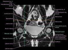 18 Mri Pelvis Ideas Mri Pelvis Pelvis Anatomy