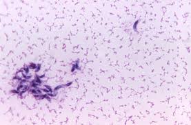 Cancer in cats is the leading cause of death among cats. Parasite Found In Cat Poop Linked To Higher Brain Cancer Risk In Humans Live Science