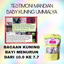 Kuning bayi ataupun jaundis merupakan salah satu fenomena yang selalu berlaku dikalangan bayi masalah kuning bayi. Newborn Mandian Kuning Bayi Jaundis Ikhtiar Menurunkan Bacaan Kuning Bayi Mandian Baby Jaundice Set Pantang Bajet Shopee Malaysia