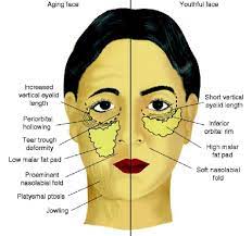 Check spelling or type a new query. Got Sunken Eyes 4 Ways To Treat Tear Trough Hollows Sunken Eyes Tear Trough Eye Treatment