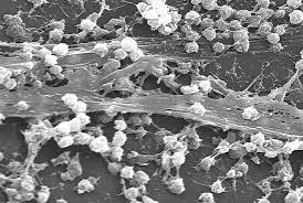 Biofilm Busting Protocol For H Pylori And Gram Negative Bacteria