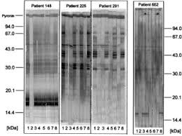 © 2019 american academy of allergy, asthma & immunology. Allergy Caused By Ingestion Of Zucchini Cucurbita Pepo Characterization Of Allergens And Cross Reactivity To Pollen And Other Foods Sciencedirect