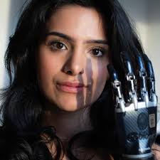 Rose, 25, har en riktig robotarm