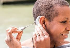 Cochlear implants bypass damaged parts of the cochlea to stimulate the auditory nerve directly. Time To Rethink Cochlear Implantation For Adults Consult Qd