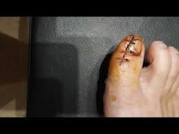 Terkos Golu Balaban Koyu Kamp Youtube