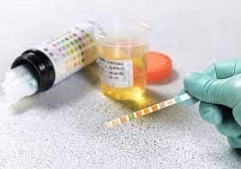 How do urine drug tests work? How Long Drugs Can Be Detected In Your System