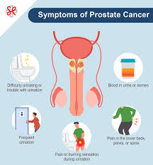 Image result for Prostate Cancer