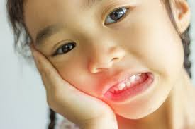 Warming hot compress place of inflammation Abscessed Tooth In Children Care Instructions Fort Worth Tx