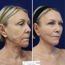 Dr. Jason Cooper Plastic Surgery