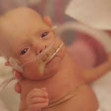 Baby Ward: Born premature at 25 weeks