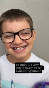 Coop's growing like a weed and now he's got braces