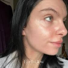 Earth Glow Skin Clinic