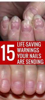 i can t believe how many disease can be identified early just by looking at your fingernails pinning now so i can find again la nail health signs fingernail health health