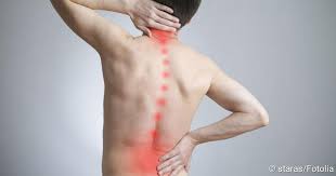 Arthrose ist eine der häufigsten erkrankungen des bewegungsapparates. Spondylarthrose Ausloser Symptome Und Behandlung Netdoktor