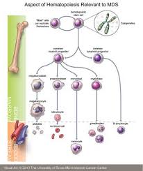 myelodysplastic syndrome md anderson cancer center