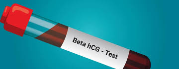 Beta HCG Test: When, Why, and How Is It ...