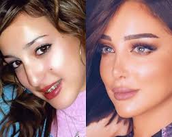 ليليا الأطرش قبل وبعد المكياج. Ø§Ù„Ù†Ø¬Ù…Ø§Øª Ù‚Ø¨Ù„ ÙˆØ¨Ø¹Ø¯ Ø¹Ù…Ù„ÙŠØ© ØªØ¬Ù…ÙŠÙ„ Ø§Ù„Ø£Ù†Ù
