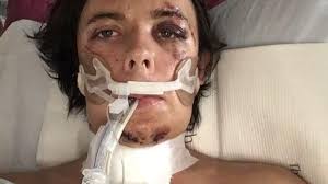 Fundraiser for Lewis Springer by Mary Sharmoota : Help Lewis "Thad" as he  recovers from tragedy