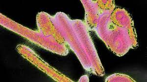 Dec 30, 2019 · ebola ist eine oft schwer verlaufende infektion mit fieber und blutungen. Erster Ausbruch Des Marburg Virus Was Vor 50 Jahren In Den Behringwerken Geschah Gesellschaft Tagesspiegel