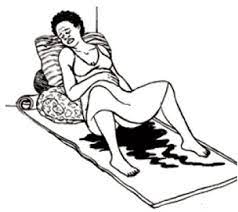 3 mia (katika namba za kirumi). 2 Kumchunguza Mwanamke Aliye Katika Leba View As Single Page