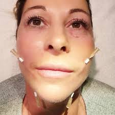 So. Die letzten Gruselbilder. Das tat alles echt weh. Bin froh dass alles  rum ist und jetzt muss ich nur fett drüber schminken solange mein Gesicht  noch grün und blau ist wie