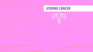 If you have any of these signs, see your doctor. Treatment Of Stages I Ii Uterine Cancer Cancerconnect