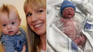 Incredible survival of six-month-old girl with meningitis given a 20 per  cent chance to live after being wrongly diagnosed with chicken pox