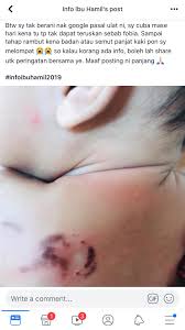 Man tgs 19 360 cara sambung treler lori kontena. Lumi On Twitter Ulat Gonggok Bahaya Gais Aku Ingat Selama Ni Dia Bergulung Buat Hal Sendiri Je Tapi Tu Semua Drama