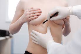 Natural-Looking Breast Augmentation in Dubai Guide