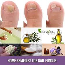 6 Home Remedies For Nail Fungus Get Rid Of Toenail Onychomycosis Nail Fungus Remedy Toenail Fungus Cure Nail Fungus Cure