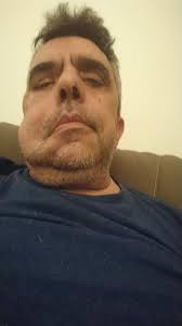 Hello! The Italian Association of Fabry Patients AIAF Onlus