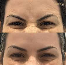 Dra.Tatiana Sena added a new photo — in...