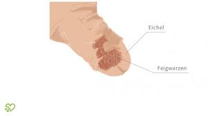 Human papillomavirus (hpv) is the most common viral infection of the reproductive tract. Hpv Symptoms Uti Can Hpv Virus Cause Uti