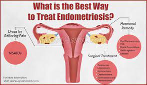 These include nsaid, hormonal contraceptive pills, depot formulations, and danazole in drug therapy. What Is The Best Way To Treat Endometriosis